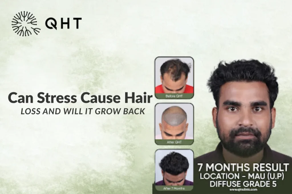 stress and hair loss