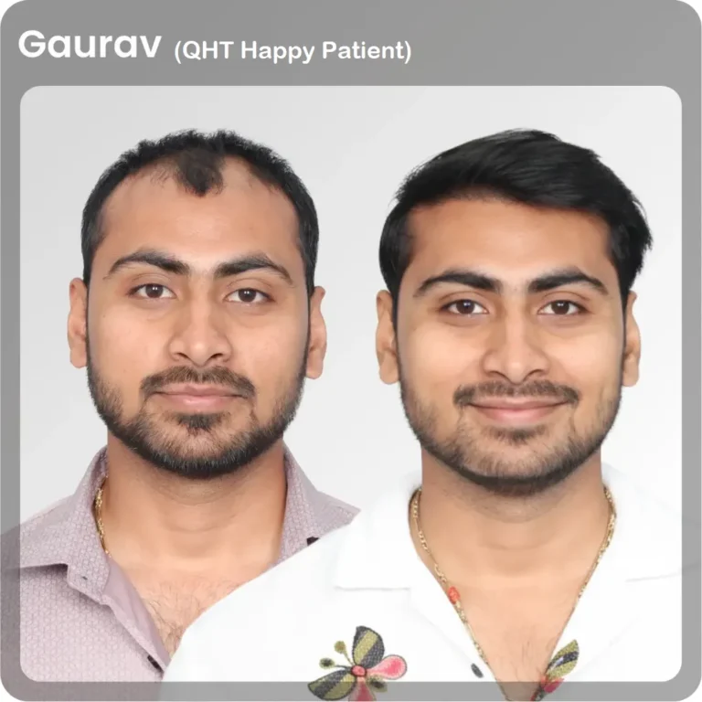 gaurav