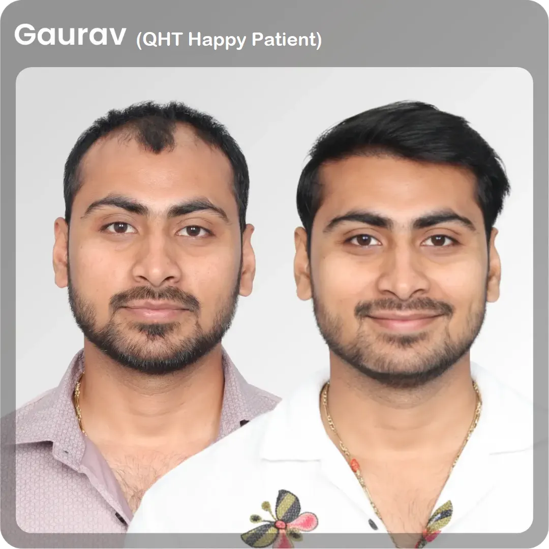 gaurav