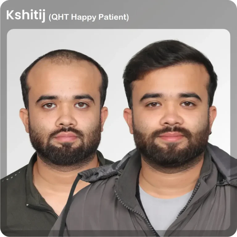 kshitij