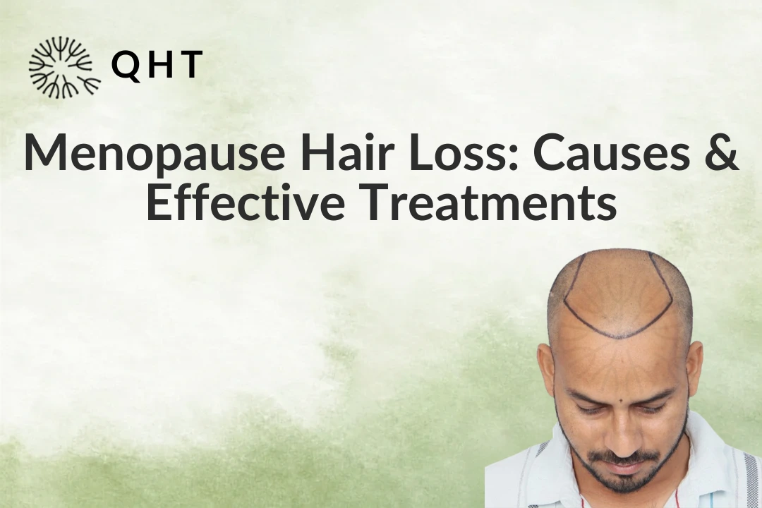 Menopause Hair Loss