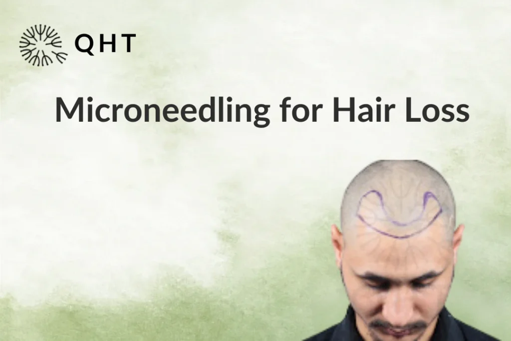 Microneedling for Hair Loss