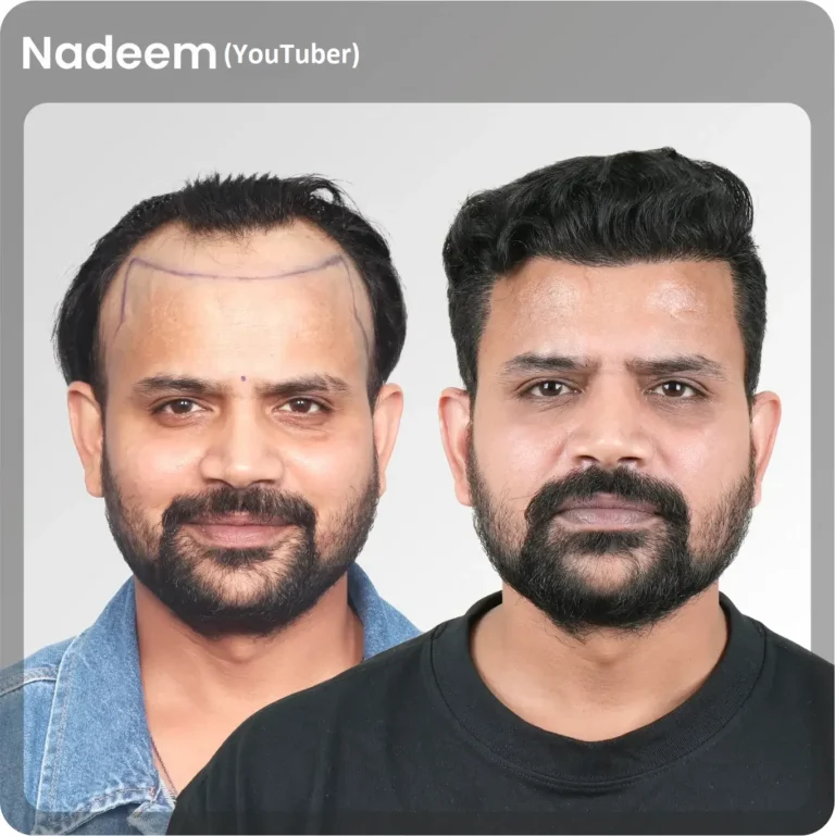 Nadeem
