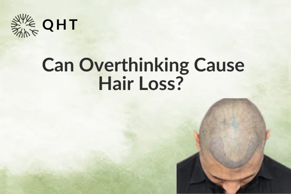 Can Overthinking Cause Hair Loss?