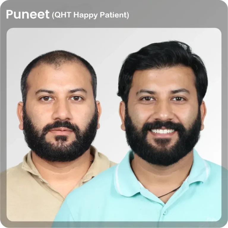 puneet
