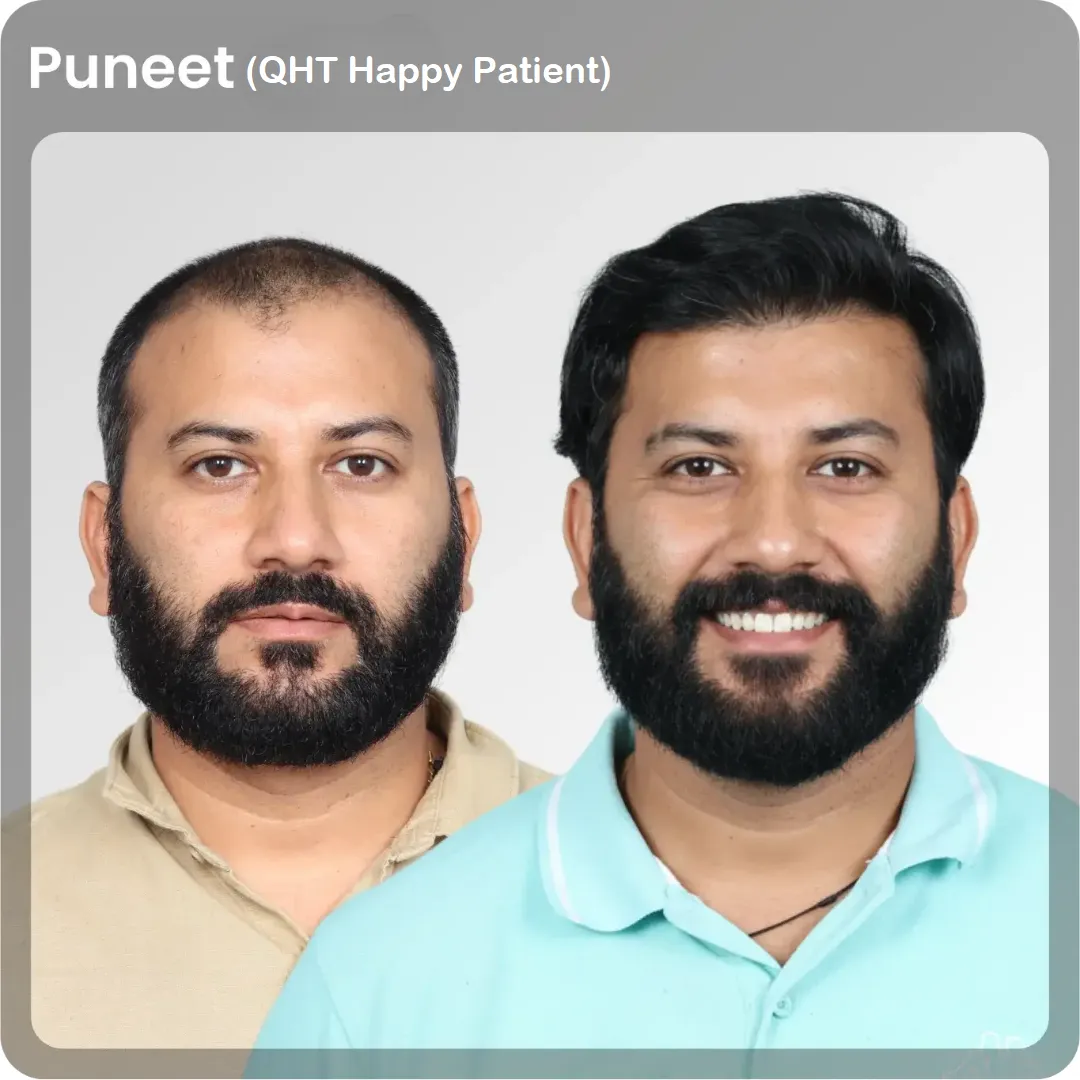 puneet