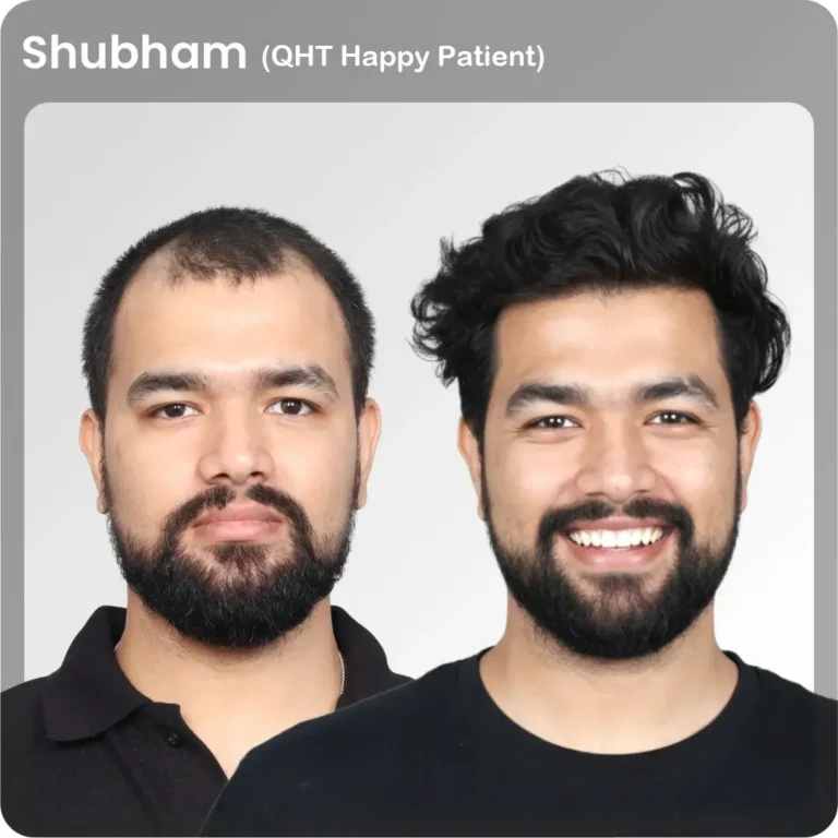Shubham