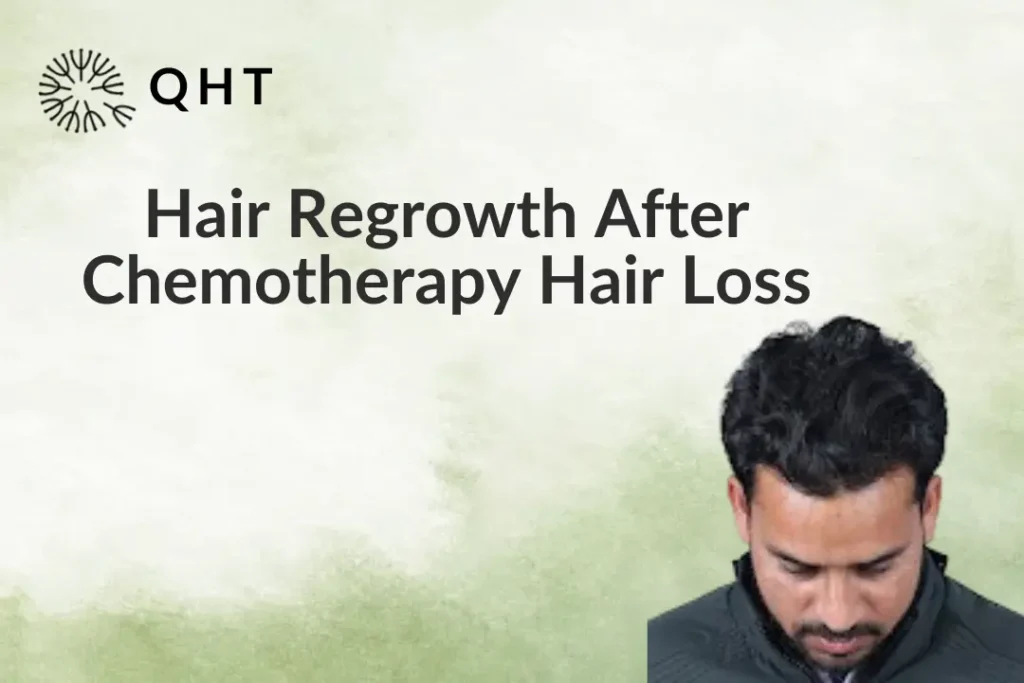 Hair Regrowth After Chemotherapy Hair Loss