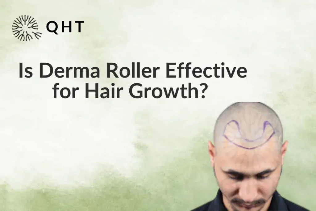 Is Derma Roller Effective for Hair Growth?
