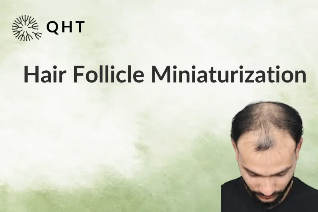 Hair Follicle Miniaturization