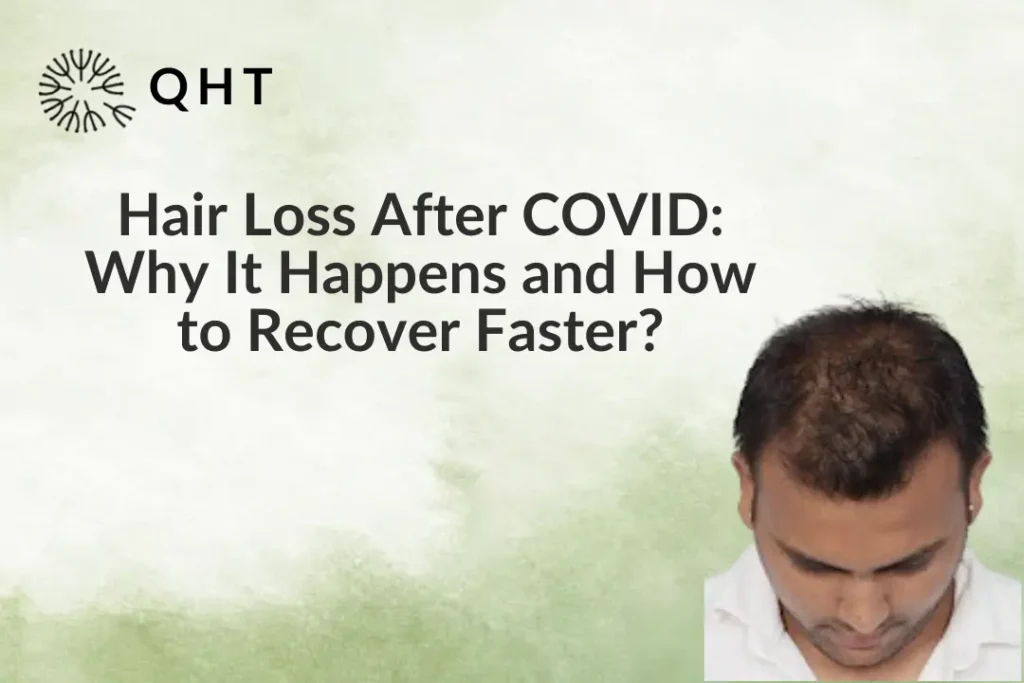 Hair Loss After COVID: Why It Happens and How to Recover Faster?