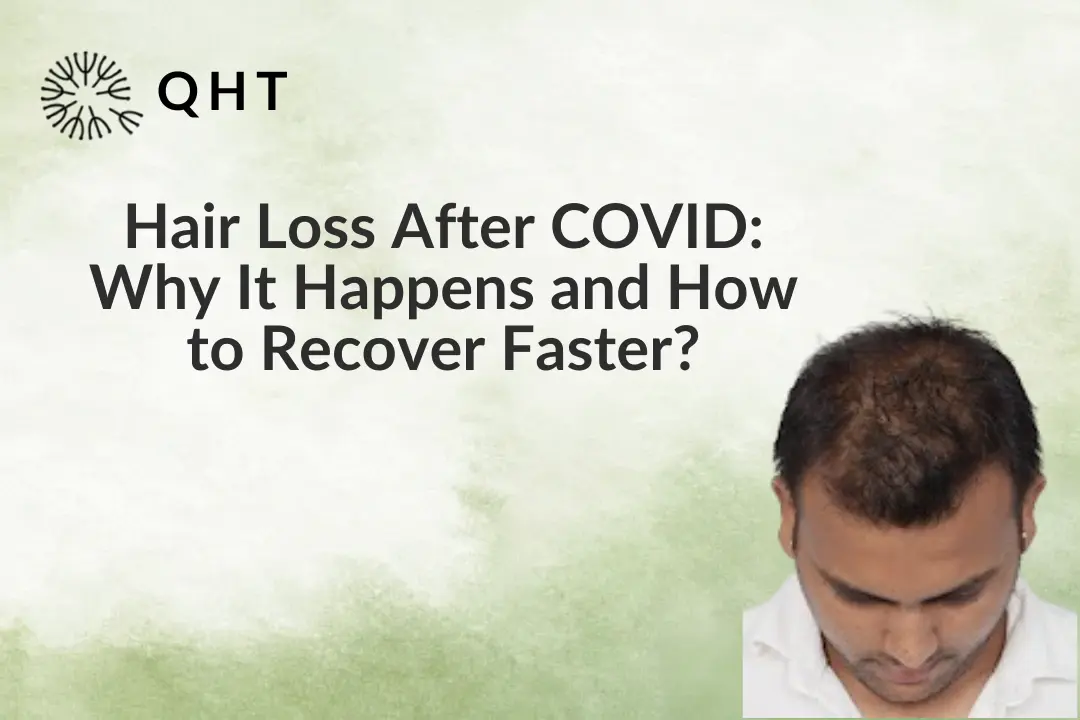 Hair Loss After COVID: Why It Happens and How to Recover Faster?