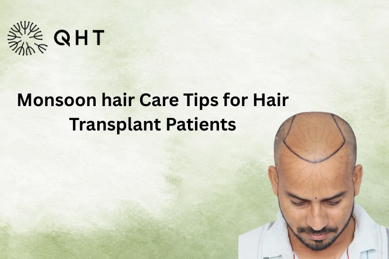 Monsoon hair Care Tips for Hair Transplant Patients