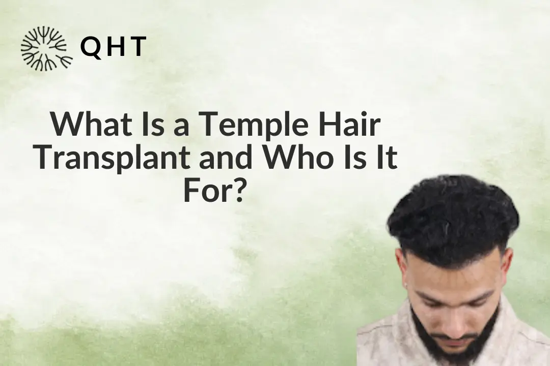 What Is a Temple Hair Transplant and Who Is It For?