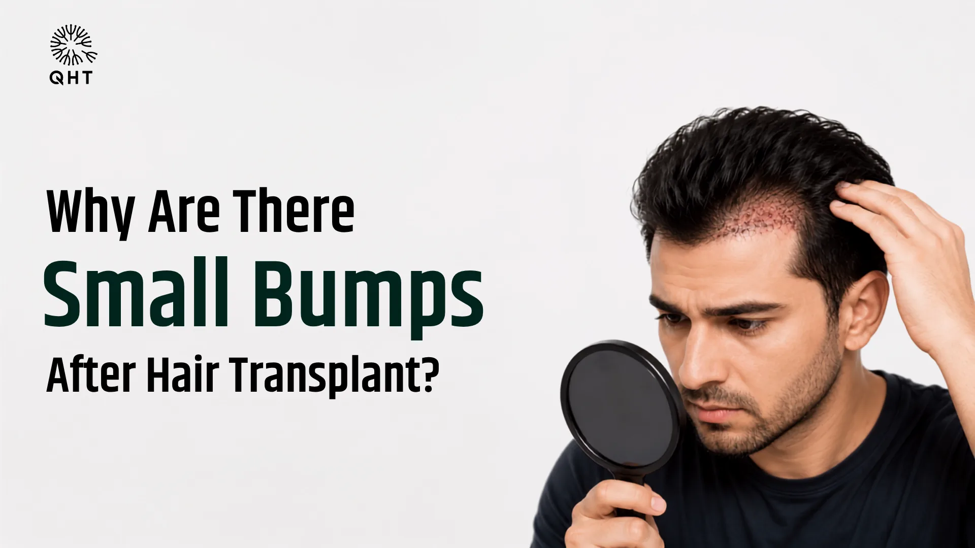 Bumps After Hair Transplant