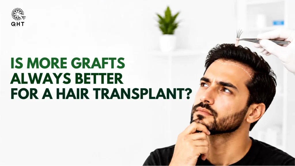 More Grafts Always Better for Hair Transplant